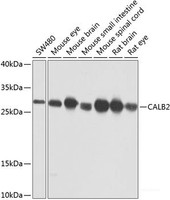 Western blot analysis of extracts of various cell lines using CALB2 Polyclonal Antibody at dilution of 1:1000.