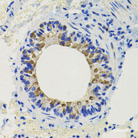 Immunohistochemistry of paraffin-embedded Mouse lung using CALB2 Polyclonal Antibody at dilution of 1:100 (40x lens) .