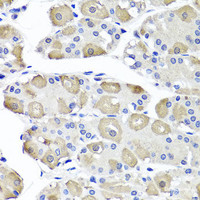 Immunohistochemistry of paraffin-embedded Human stomach using OTC Polyclonal Antibody at dilution of 1:100 (40x lens) .