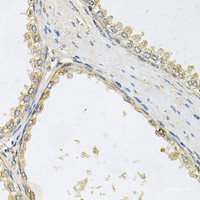 Immunohistochemistry of paraffin-embedded Human prostate using POMGNT1 Polyclonal Antibody at dilution of 1:100 (40x lens) .