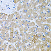 Immunohistochemistry of paraffin-embedded Human liver damage using POMGNT1 Polyclonal Antibody at dilution of 1:100 (40x lens) .