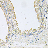 Immunohistochemistry of paraffin-embedded Human prostate using ANKH Polyclonal Antibody at dilution of 1:100 (40x lens) .