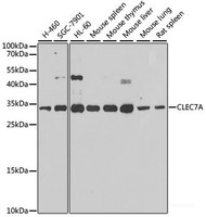 Western blot analysis of extracts of various cell lines using CLEC7A Polyclonal Antibody at dilution of 1:1000.