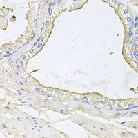 Immunohistochemistry of paraffin-embedded Human prostate using HPR Polyclonal Antibody at dilution of 1:100 (40x lens) .