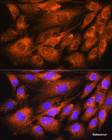 Immunofluorescence analysis of C6 cells using ATP5D Polyclonal Antibody at dilution of 1:100. Blue: DAPI for nuclear staining.