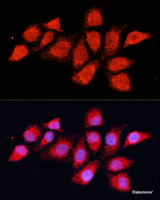 Immunofluorescence analysis of HeLa cells using PDHA2 Polyclonal Antibody at dilution of 1:100 (40x lens) . Blue: DAPI for nuclear staining.