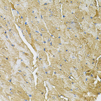 Immunohistochemistry of paraffin-embedded Mouse heart using TRPC1 Polyclonal Antibody