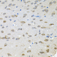 Immunohistochemistry of paraffin-embedded Rat brain using TRPC1 Polyclonal Antibody