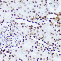 Immunohistochemistry of paraffin-embedded Rat kidney using Phospho-ABL1 (Y245) Polyclonal Antibody at dilution of 1:100 (40x lens) .