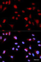 Immunofluorescence analysis of MCF-7 cells using Phospho-ABL1 (Y204) Polyclonal Antibody