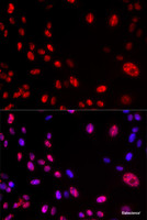 Immunofluorescence analysis of U2OS cells using Phospho-ATM (S1981) Polyclonal Antibody