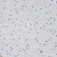 Immunohistochemistry of paraffin-embedded Mouse brain using Phospho-CDK1 (Y15) Polyclonal Antibody at dilution of 1:100 (40x lens) .