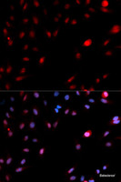 Immunofluorescence analysis of MCF-7 cells using Phospho-CDK1 (Y15) Polyclonal Antibody