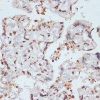 Immunohistochemistry of paraffin-embedded Human placenta using Phospho-CHEK1 (S280) Polyclonal Antibody at dilution of 1:100 (40x lens) .