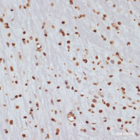 Immunohistochemistry of paraffin-embedded Mouse brain using Phospho-CHEK1 (S280) Polyclonal Antibody at dilution of 1:100 (40x lens) .