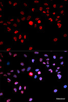 Immunofluorescence analysis of MCF-7 cells using Phospho-CREB1 (S133) Polyclonal Antibody