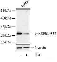 Western blot analysis of extracts of HeLa cells using Phospho-HSPB1 (S82) Polyclonal Antibody at dilution of 1:1000. HeLa cells were treated by EGF (100ng/ml) for 30 minutes after serum-starvation overnight.