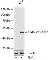 Western blot analysis of extracts of various cell lines using Phospho-MAP2K1 (S217) Polyclonal Antibody at dilution of 1:1000. HeLa cells were treated by PMA/TPA (200 nM) at 37°C for 15 minutes after serum-starvation overnight.