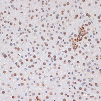 Immunohistochemistry of paraffin-embedded Mouse liver using Phospho-Stat3 (Y705) Polyclonal Antibody at dilution of 1:100 (40x lens) .