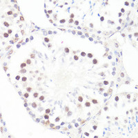 Immunohistochemistry of paraffin-embedded Mouse testis using Phospho-MYC (S62) Polyclonal Antibody at dilution of 1:100 (40x lens) .