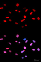 Immunofluorescence analysis of U2OS cells using Phospho-Rb (S811) Polyclonal Antibody