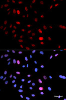 Immunofluorescence analysis of U2OS cells using Phospho-SMC1A (S957) Polyclonal Antibody