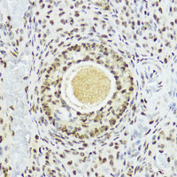 Immunohistochemistry of paraffin-embedded Rat ovary using Phospho-Histone H3 (T11) Polyclonal Antibody at dilution of 1:100 (40x lens) .