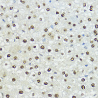 Immunohistochemistry of paraffin-embedded Rat liver using Phospho-Histone H3 (T11) Polyclonal Antibody at dilution of 1:100 (40x lens) .