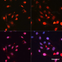 Immunofluorescence analysis of U2OS cells using Phospho-γH2A.X (S139) Polyclonal Antibody at dilution of 1:100. Blue: DAPI for nuclear staining.U2OS cells were treated by UV for 15-30 minutes at RT (left) . Blue: DAPI for nuclear staining.