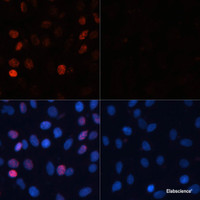 Immunofluorescence analysis of C6 cells using Phospho-γH2A.X (S139) Polyclonal Antibody at dilution of 1:100. Blue: DAPI for nuclear staining.C6 cells were treated by UV for 15-30 minutes at RT (left) . Blue: DAPI for nuclear staining.