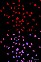 Immunofluorescence analysis of U2OS cells using Phospho-Btk (Y223) Polyclonal Antibody