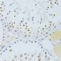 Immunohistochemistry of paraffin-embedded Rat testis using Phospho-NF-kB p65 (S276) Polyclonal Antibody at dilution of 1:100 (40x lens) .