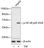 Western blot analysis of extracts from HepG2 cells using Phospho-NF-kB p65 (S536) Polyclonal Antibody.