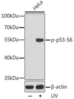 Western blot analysis of extracts from HeLa cells using Phospho-p53 (S6) Polyclonal Antibody.