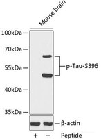 Western blot analysis of extracts from Mouse brain tissue using Phospho-Tau (S396) Polyclonal Antibody.