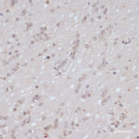 Immunohistochemistry of paraffin-embedded Rat brain using Phospho-BRCA1 (S1423) Polyclonal Antibody at dilution of 1:100 (40x lens) .