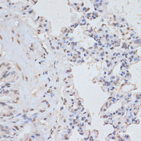 Immunohistochemistry of paraffin-embedded Rat lung using Phospho-MAPK3 (Y204) Polyclonal Antibody at dilution of 1:100 (40x lens) .