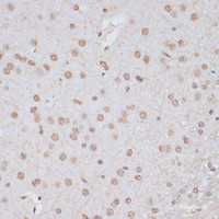 Immunohistochemistry of paraffin-embedded Rat brain using Phospho-MAPK3 (Y204) Polyclonal Antibody at dilution of 1:100 (40x lens) .