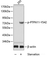 Western blot analysis of extracts from 293 cells using Phospho-PTPN11 (Y542) Polyclonal Antibody.