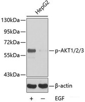 Western blot analysis of extracts HepG2 cells using Phospho-AKT1（Y315）/AKT2（Y316）/AKT3（Y312） Polyclonal Antibody.