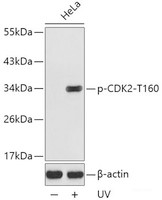 Western blot analysis of extracts from HeLa cells using Phospho-CDK2 (T160) Polyclonal Antibody.