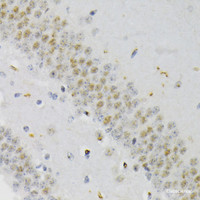 Immunohistochemistry of paraffin-embedded Mouse brain using Phospho-CREB1 (S133) Polyclonal Antibody at dilution of 1:200 (40x lens) .