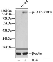 Western blot analysis of extracts from HT29 cells using Phospho-JAK2 (Y1007) Polyclonal Antibody.