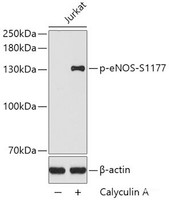 Western blot analysis of extracts of Jurkat cells using Phospho-eNOS (S1177) Polyclonal Antibody.