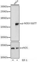 Western blot analysis of extracts of HeLa cells using Phospho-eNOS (S1177) Polyclonal Antibody at dilution of 1:1000.