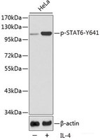 Western blot analysis of extracts from HeLa cells using Phospho-STAT6 (Y641) Polyclonal Antibody.