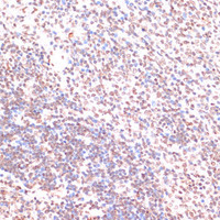 Immunohistochemistry of paraffin-embedded Rat spleen using Phospho-ERK1（T202/Y204）/ ERK2（T185/Y187） Polyclonal Antibody at dilution of 1:100 (40x lens) .