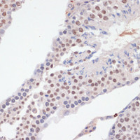 Immunohistochemistry of paraffin-embedded Mouse testis using Phospho-NF-kB p65 (S536) Polyclonal Antibody at dilution of 1:200 (40x lens) .