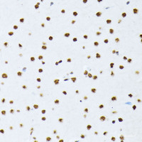 Immunohistochemistry of paraffin-embedded Rat brain using Phospho-ATF2 (T69/T71) Polyclonal Antibody at dilution of 1:100 (40x lens) .