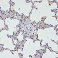 Immunohistochemistry of paraffin-embedded Rat lung using Phospho-Jak2 (Y1007/1008) Polyclonal Antibody at dilution of 1:200 (40x lens) .